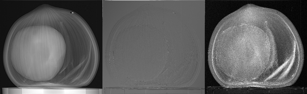 Cross-sectional medical image showing a circular structure with surrounding soft tissue; grayscale MRI/CT slices.